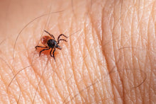 Detailed macro shot of a tick crawling on human skin, showing texture.