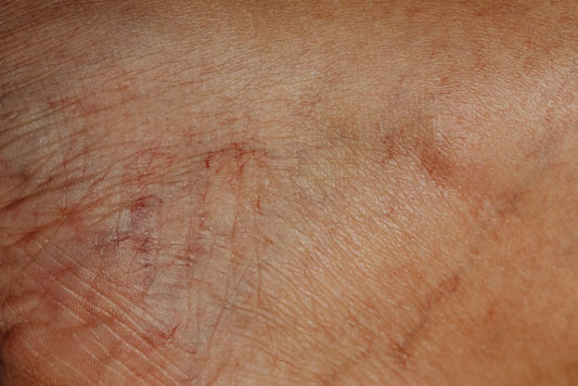 Detailed close-up image highlighting the texture and wrinkles of aging human skin.